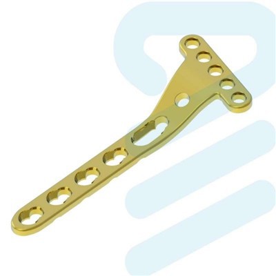 Placă de blocare a razei distale