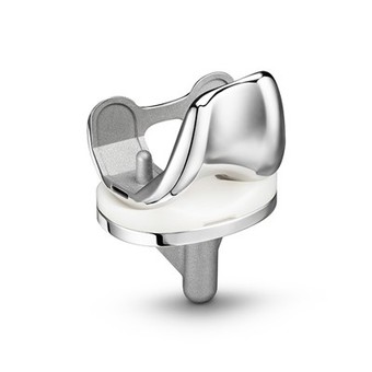 Implant total de înlocuire a genunchiului